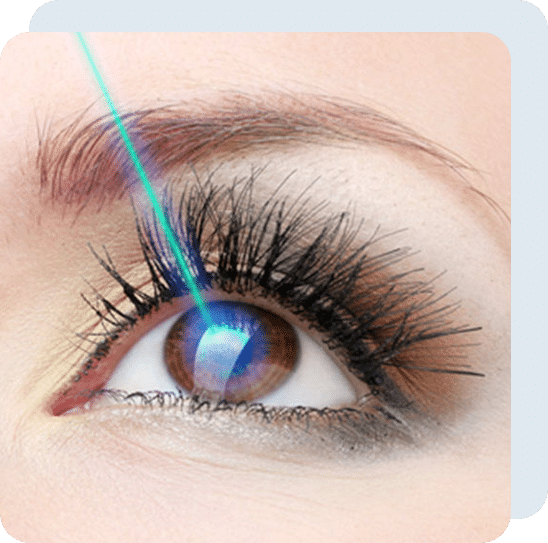 Frequently asked questions - LASIK