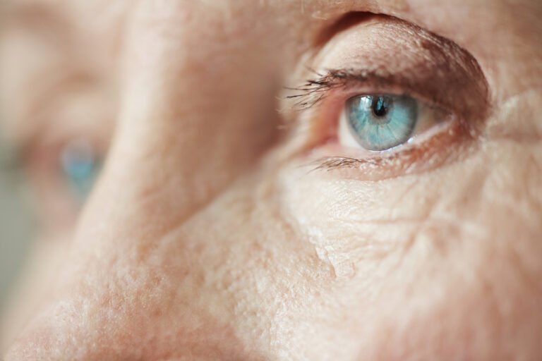 cataract